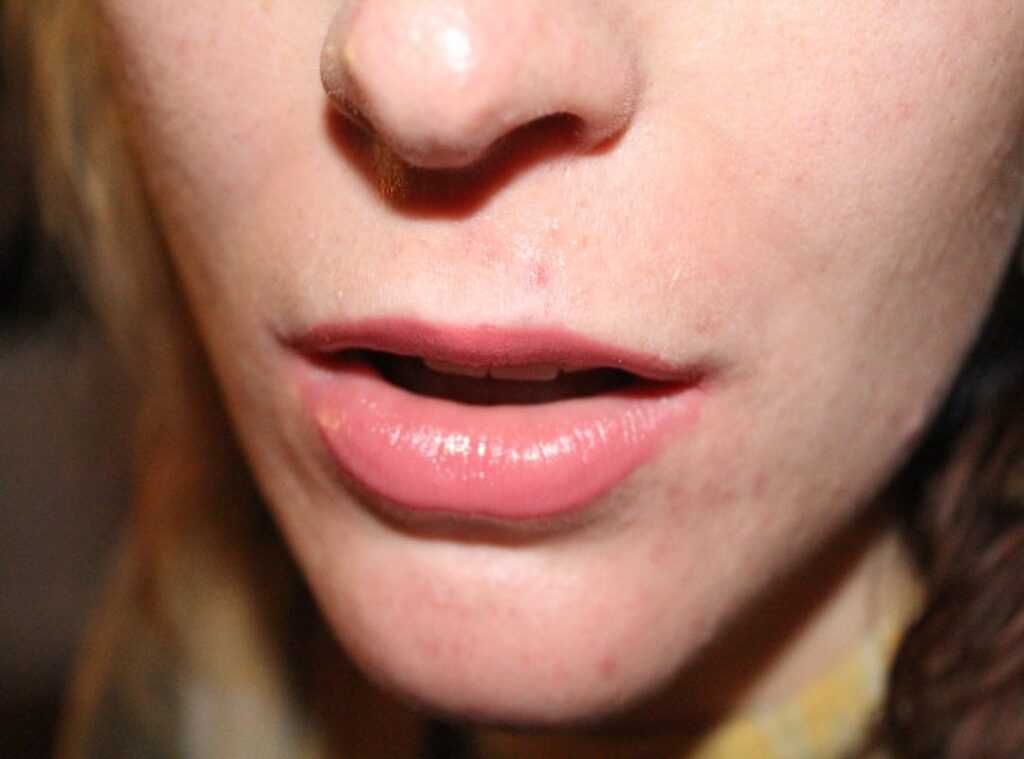 bold lips techniques